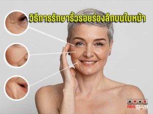 รักษาริ้วรอยบนใบหน้า ริ้วรอยบนใบหน้า ริ้วรอย Wrinkles ใช้อะไรลดริ้วรอย ทำยังไงให้ริ้วรอยหาย