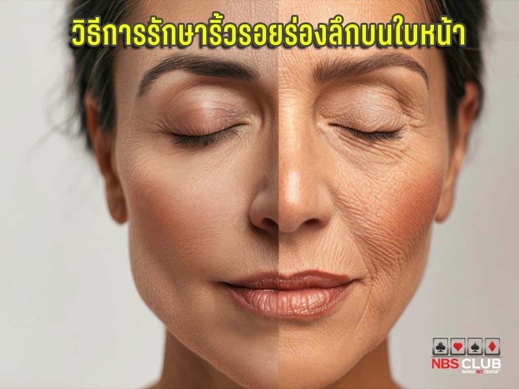 รักษาริ้วรอยบนใบหน้า ริ้วรอยบนใบหน้า ริ้วรอย Wrinkles ใช้อะไรลดริ้วรอย ทำยังไงให้ริ้วรอยหาย